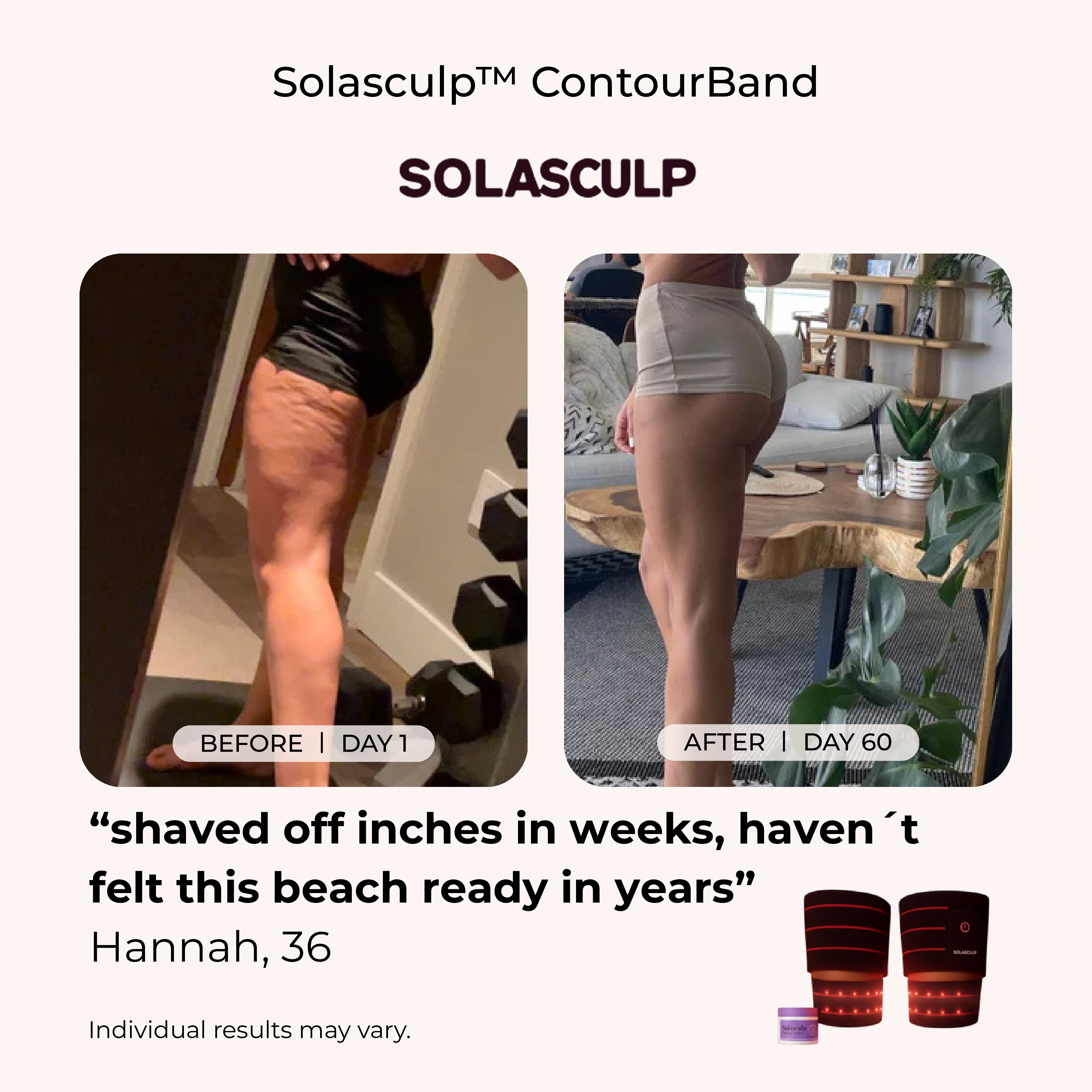 Solasculp™ ContourBand