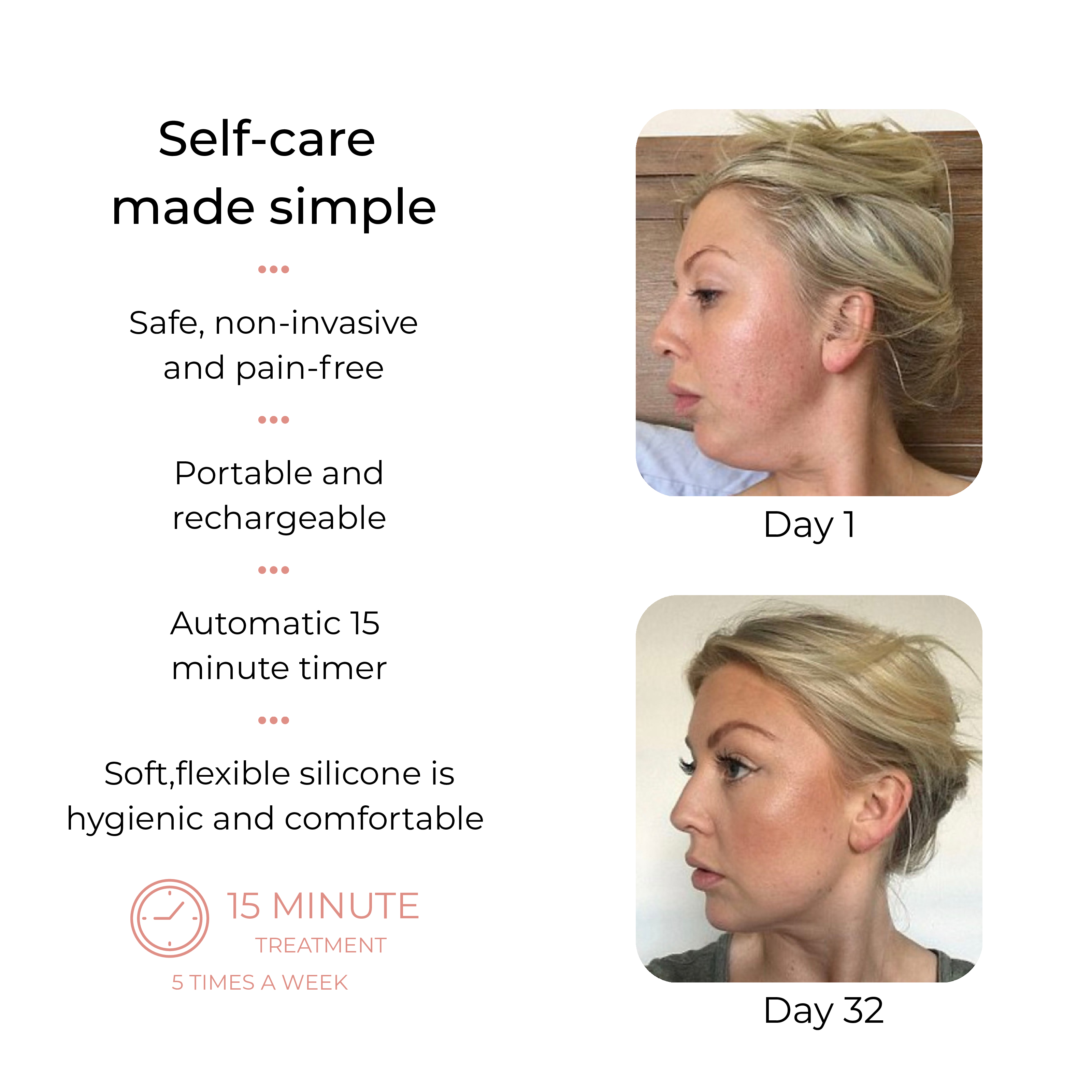 Solasculp™ LiftBand