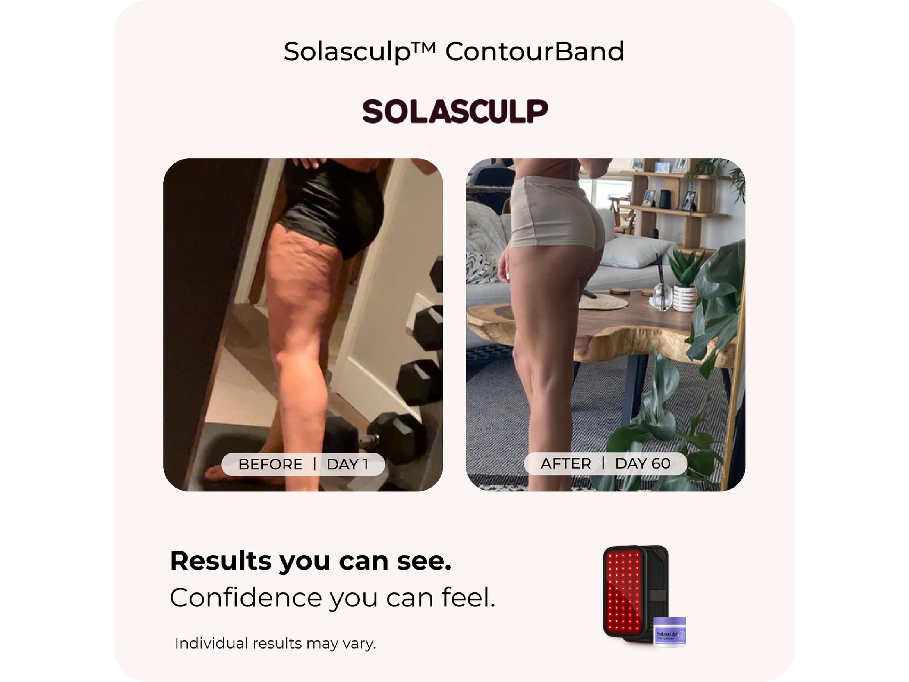 Solasculp™ ContourBand – Arm & Thigh Red Light Therapy