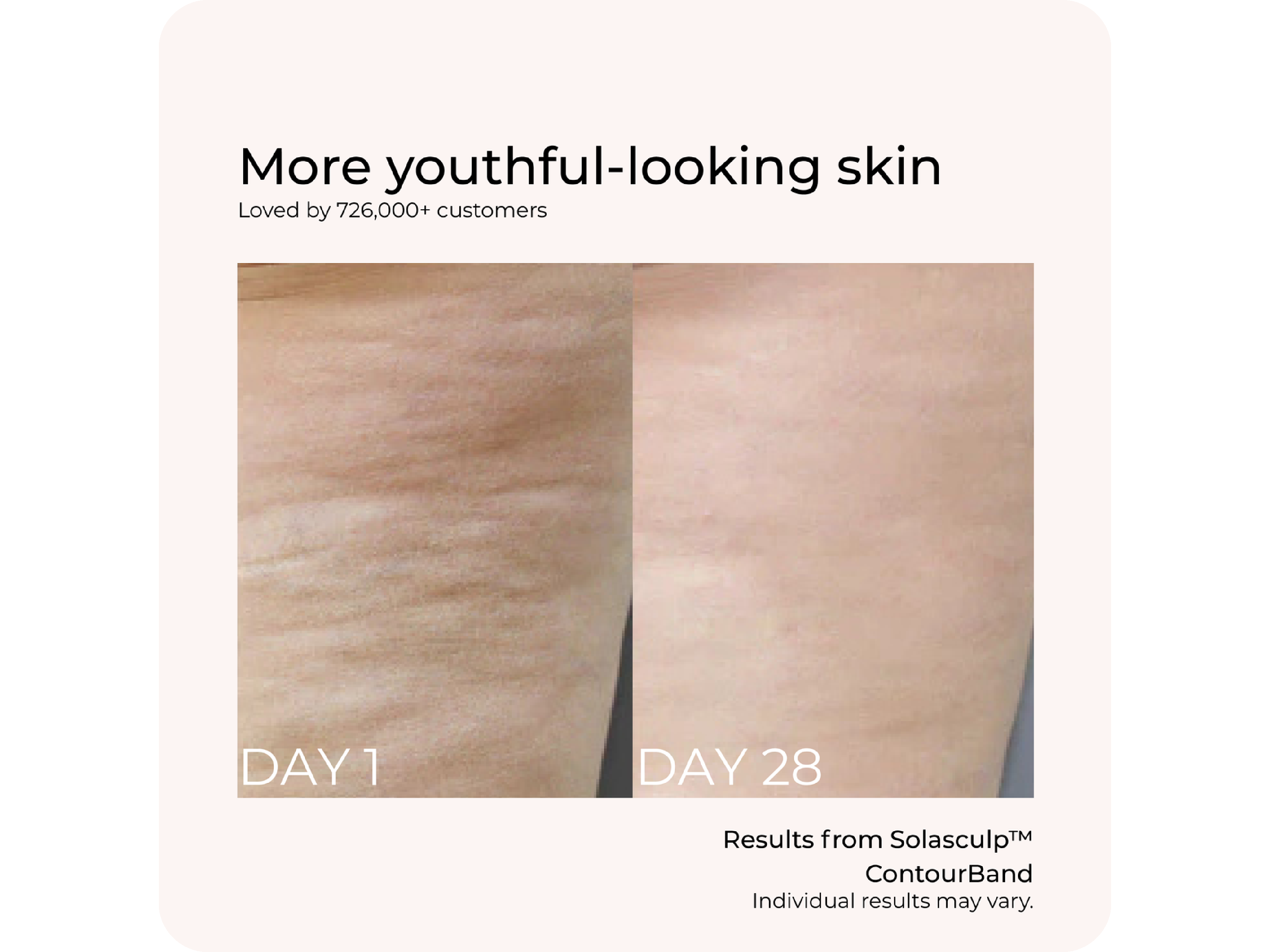 Solasculp™ ContourBand – Arm & Thigh Red Light Therapy