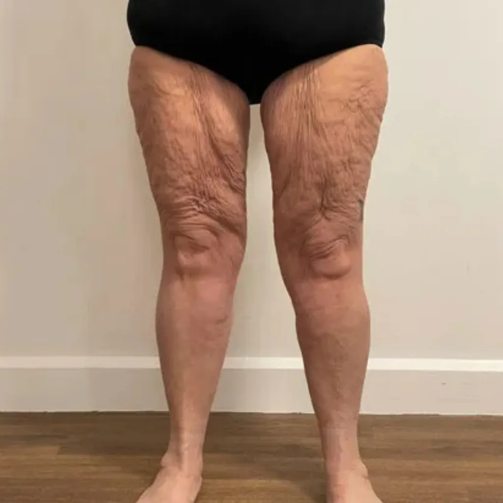 Amanda, 48, day 1