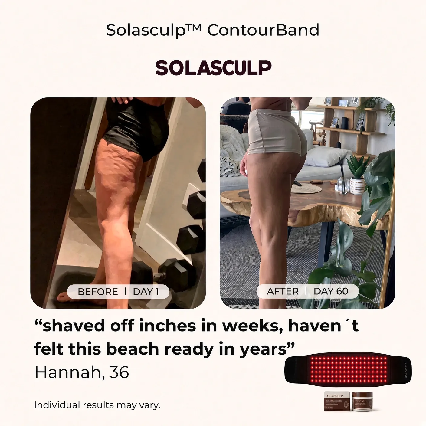 Back of thigh, day 1 and day 60