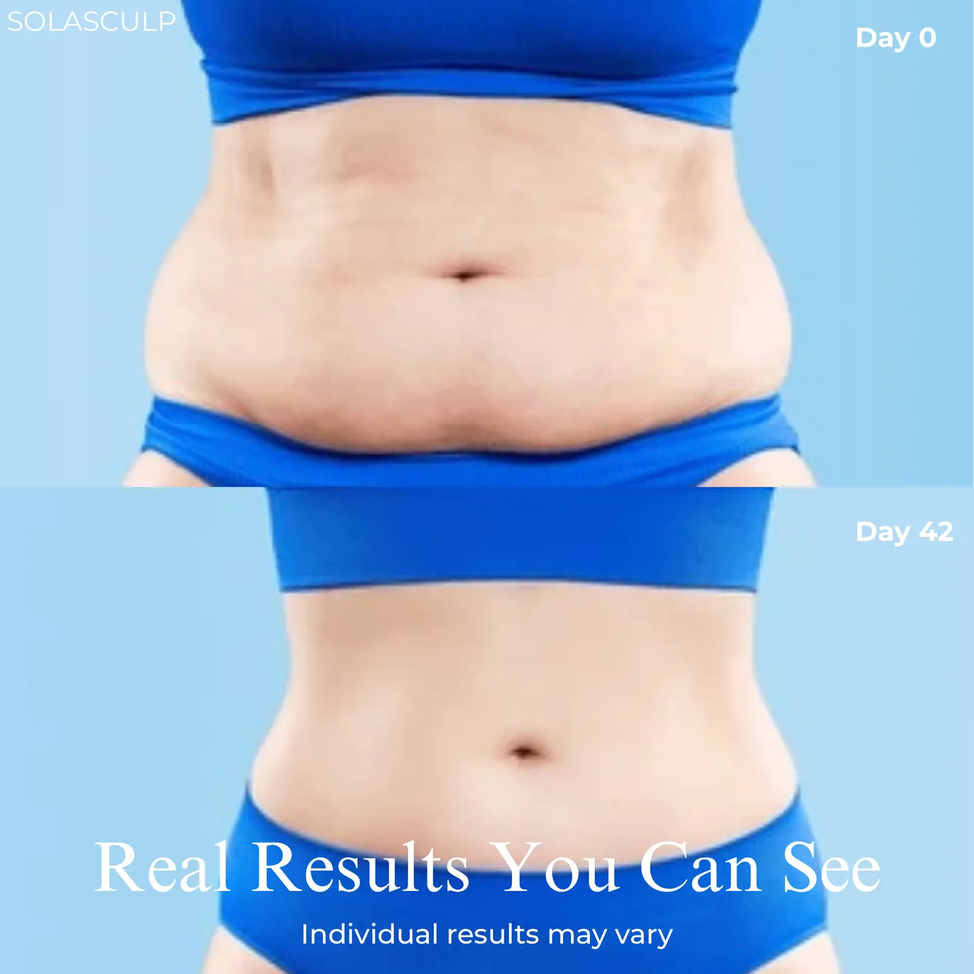 Loose skin, Day 0 and Day 42